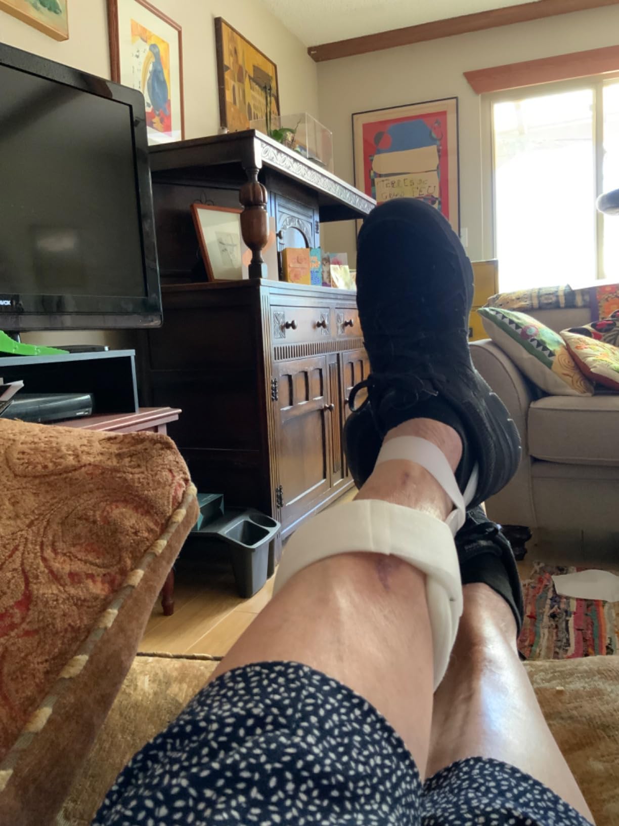 Swedish Deluxe AFO Drop Foot Stabilizer Brace customer photo 2