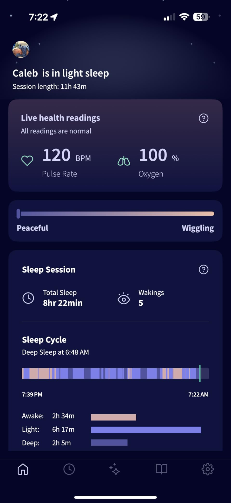 Owlet Dream Sock - Smart Baby Monitor View Heart Rate and Average Oxygen O2 as Sleep Quality Indicators. Wakings, Movement, and Sleep State. Digital Sleep Coach and Sleep Assist Prompts - Mint customer photo 1