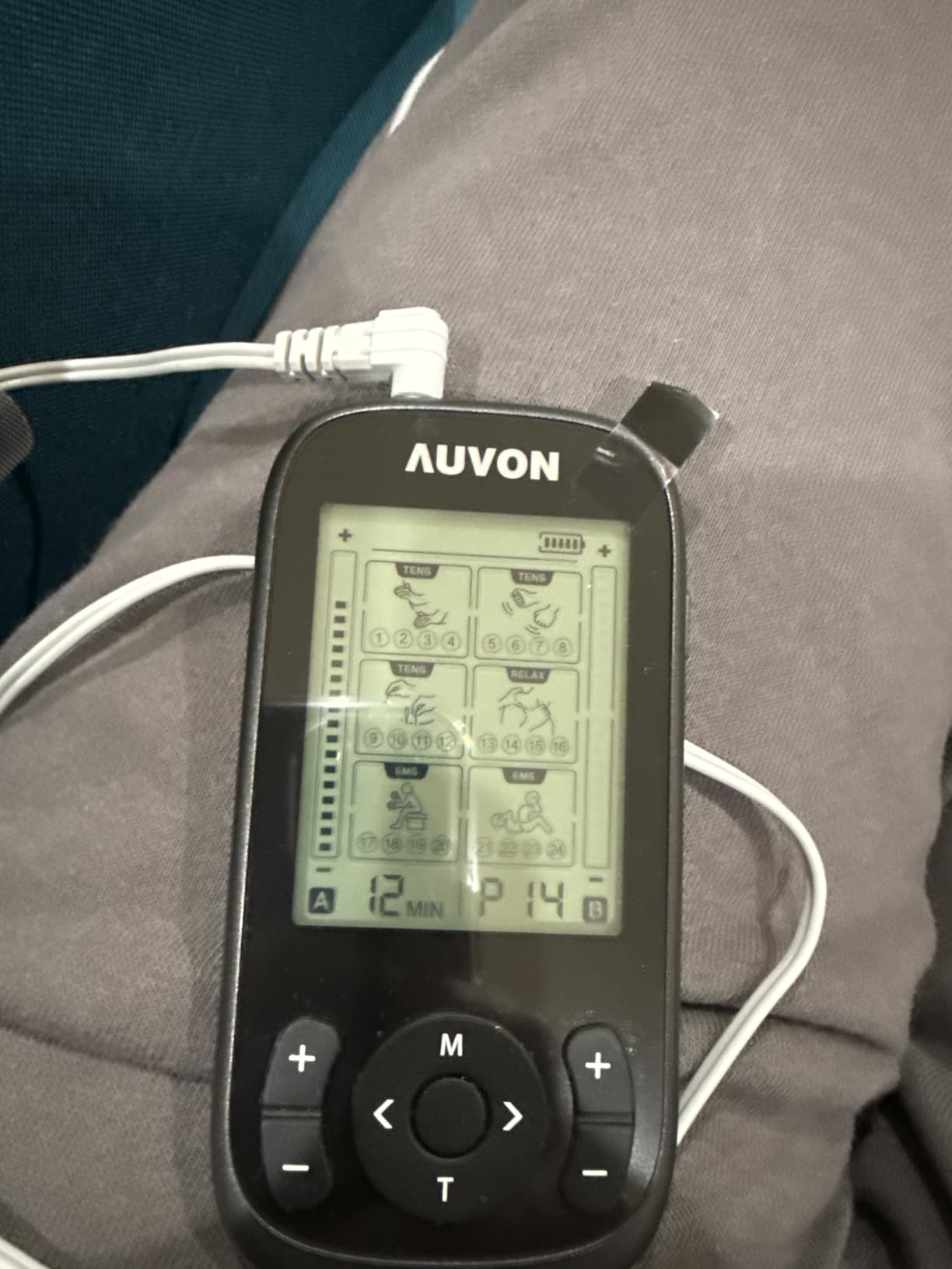AUVON 3-in-1 TENS Unit Muscle Stimulator, EMS Massage Machine with 40 Intensities for Gradual Shoulder, Sciatica, Back Pain Relief, 24 Modes Rechargeable Electronic Pulse Massager with 12 TENS Pads customer photo 1