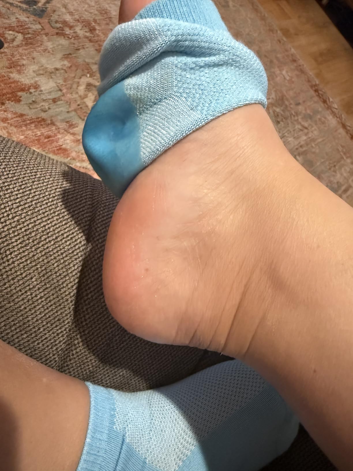 Callus Remover for Feet (Extra Strength) Foot Callus Remover Gel - Pedicure Tools for Feet Scrubber - Foot Care Spa Essentials, 6oz customer photo 1