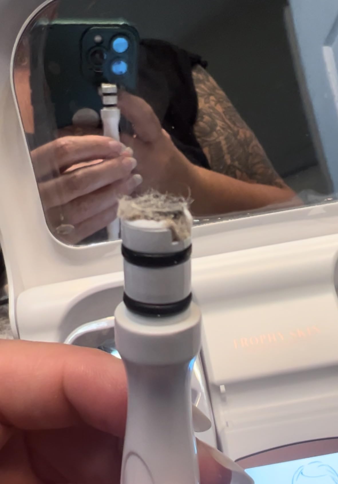 Trophy Skin MicrodermMD - At Home Microdermabrasion Kit - Anti Aging and Acne Treatment - Contains Real Diamond and Pore Extractor Tips to Rejuvenate Skin customer photo 2
