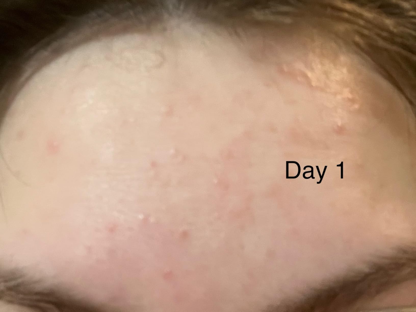SOME BY MI Bye Bye Blackhead 30 Days Miracle Green Tea Tox Bubble Cleanser, 4.23oz, 120g, Korean Face Wash & Bubble Face Mask, Daily Blackhead-Removing Pore Minimizer for Face, Korean Skin Care customer photo 2