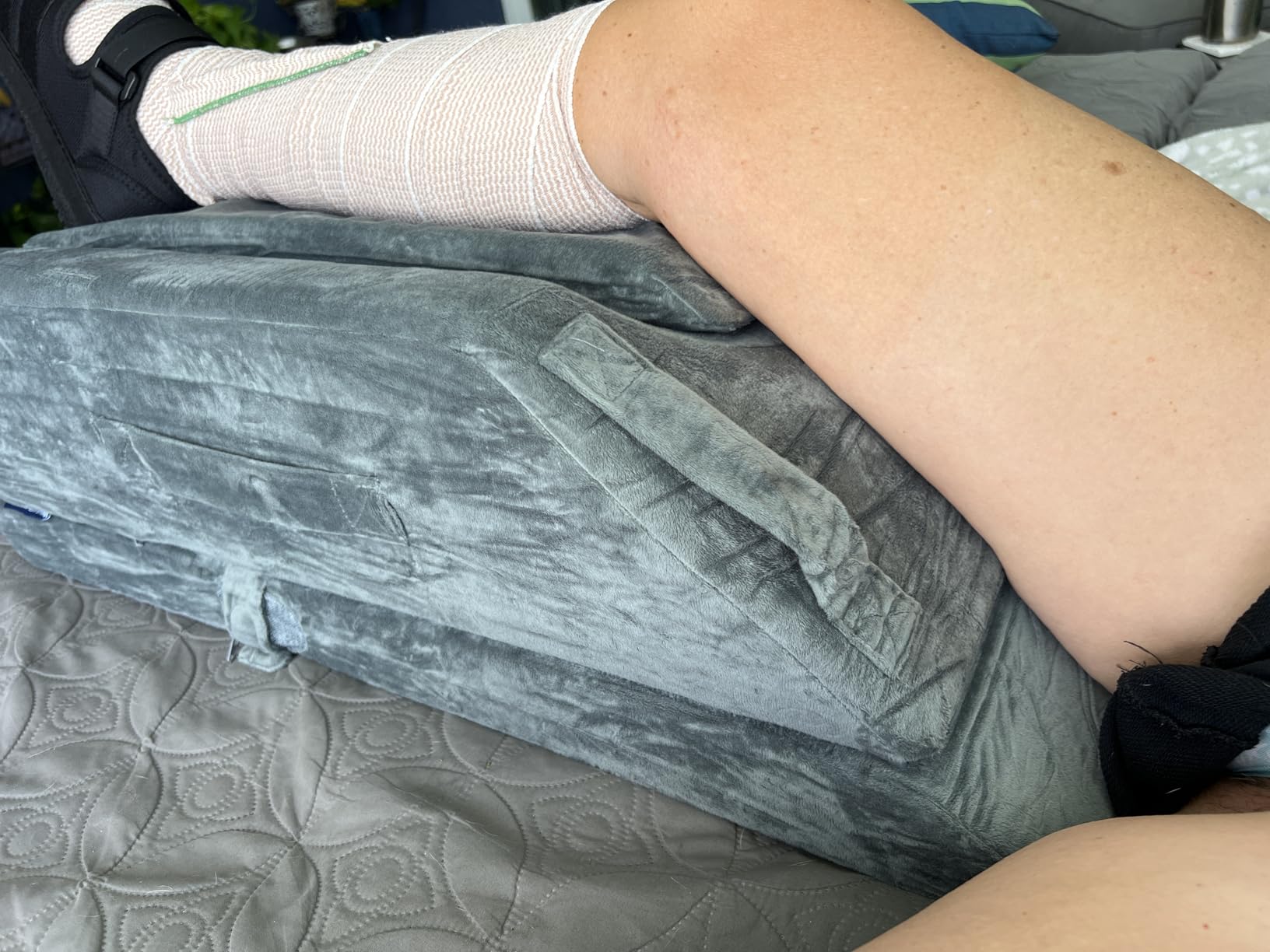 KingPavonini 4-Height Adjustable Leg Elevation Pillows for After Surgery, Injuries, or Rest, Memory Foam Leg Pillows for Sleeping with 3 Handles and Insert Pad, Washable Velvet Cover customer photo 1