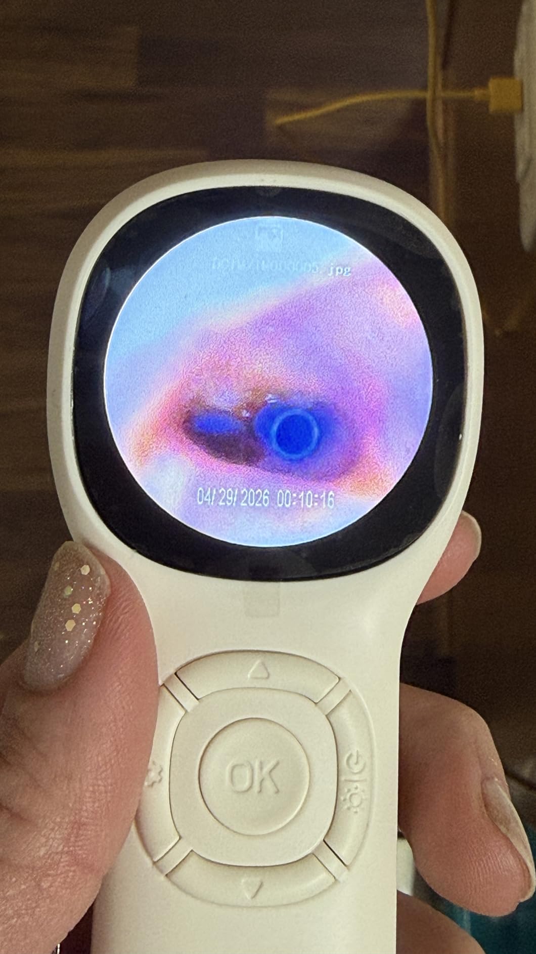 ScopeAround Digital Otoscope w/Built-in Screen, Manual-Focus Digital Otoscope with Light for Home Use, No App Needed, Easy Viewing for Everyday Ear Checks, Otoscope Camera, White customer photo 1