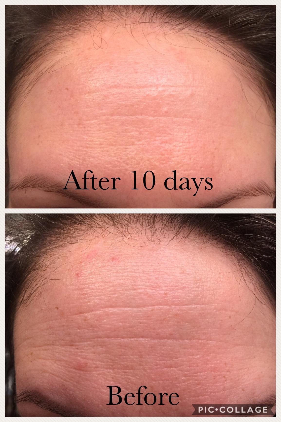 Neutrogena Rapid Wrinkle Repair Retinol Face Moisturizer with SPF 30 Sunscreen, Daily Anti-Aging Face Cream with Retinol & Hyaluronic Acid to Fight Fine Lines, Wrinkles, & Dark Spots, 1 fl. oz customer photo 1