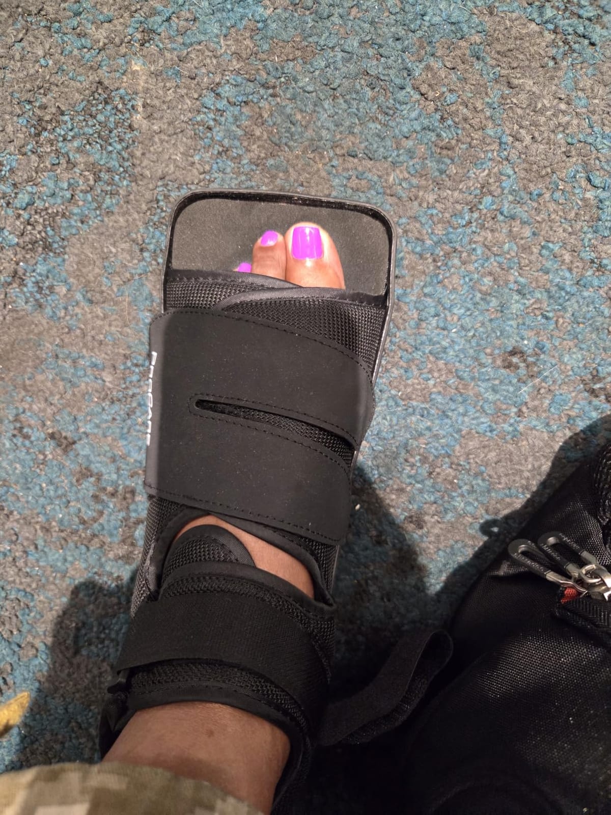 ProCare 79-81237 Squared Toe Post-Op Shoe customer photo 2