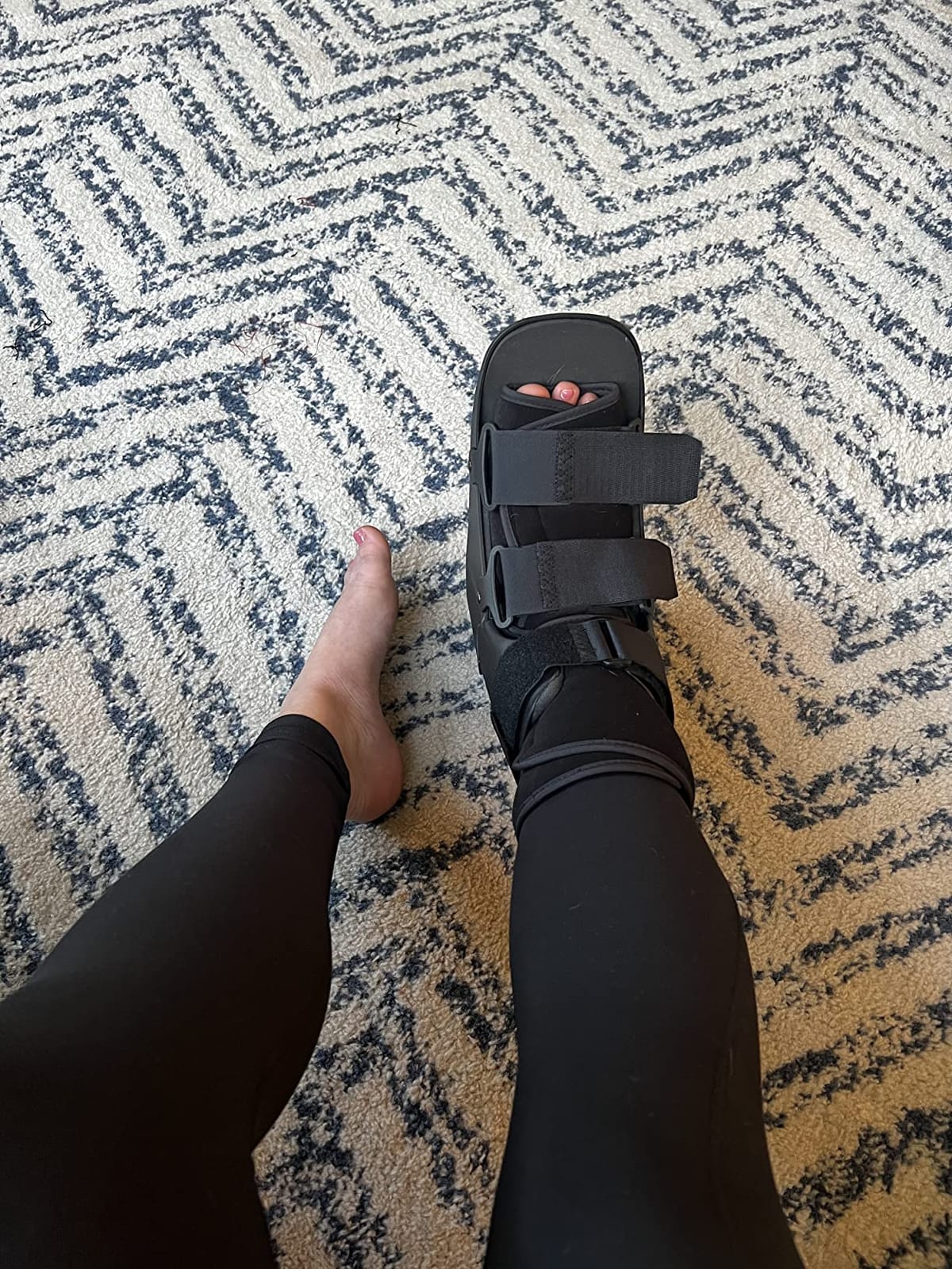 United Ortho USA14015 Short Cam Walker Fracture Boot, Medium, Black customer photo 1