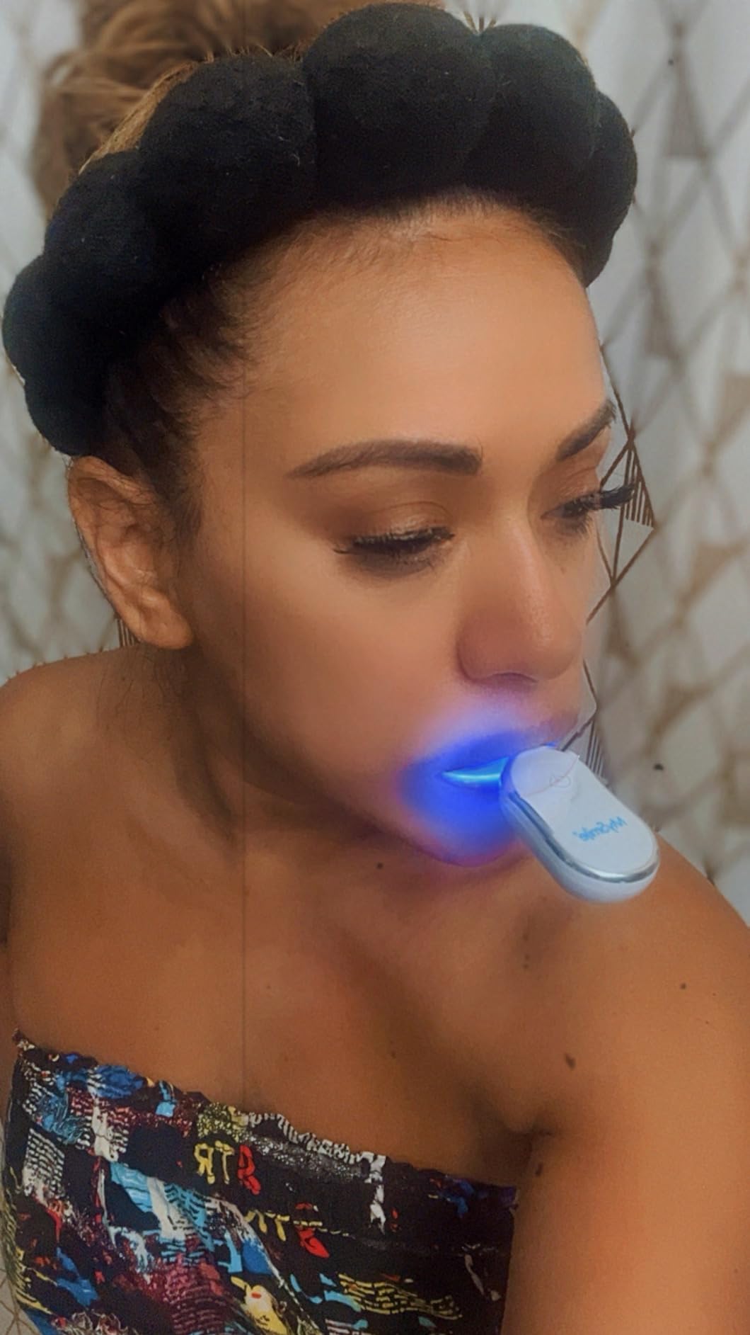 MySmile Teeth Whitening Kit for Sensitive Teeth, 30+ Treatments Whitener customer photo 2