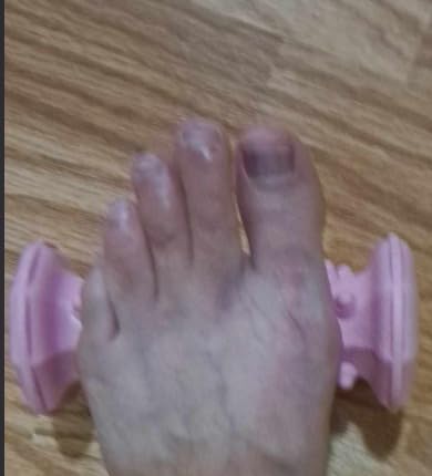 Foot Massager Roller for Plantar Fasciitis, Arch Heel Pain Relief customer photo 1