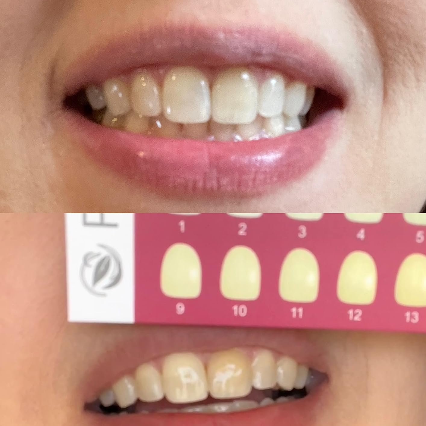 Teeth Whitening Kit with LED Light Tray for Sensitive Teeth, 5 Tooth Whitening Pen Gel Pain Free and Enamel Safe, Teeth Whitener at Home Up to 1-9 Shades Whiter in 1-2 Weeks customer photo 2